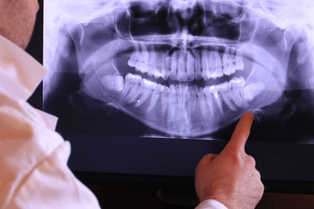 Best Emergency TMJ Treatment in Mlstadt, IL